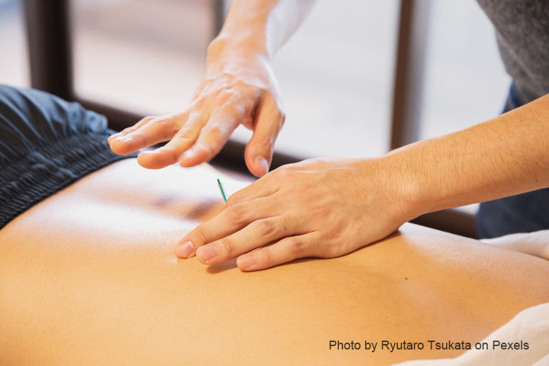 Different Acupuncture Methods